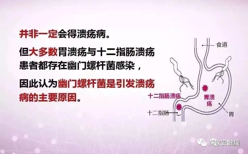 感染了Hp一定会得胃溃疡吗